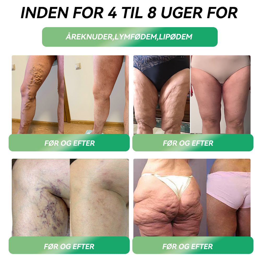 🎁Tillykke! Du er en af vores heldige vindere! 💪 Som vores eksklusive lykkestjerne får du nu en fantastisk rabat på 20%! Gå ikke glip af denne unikke mulighed for at forkæle dig selv med noget helt særligt! 🛍️💫
