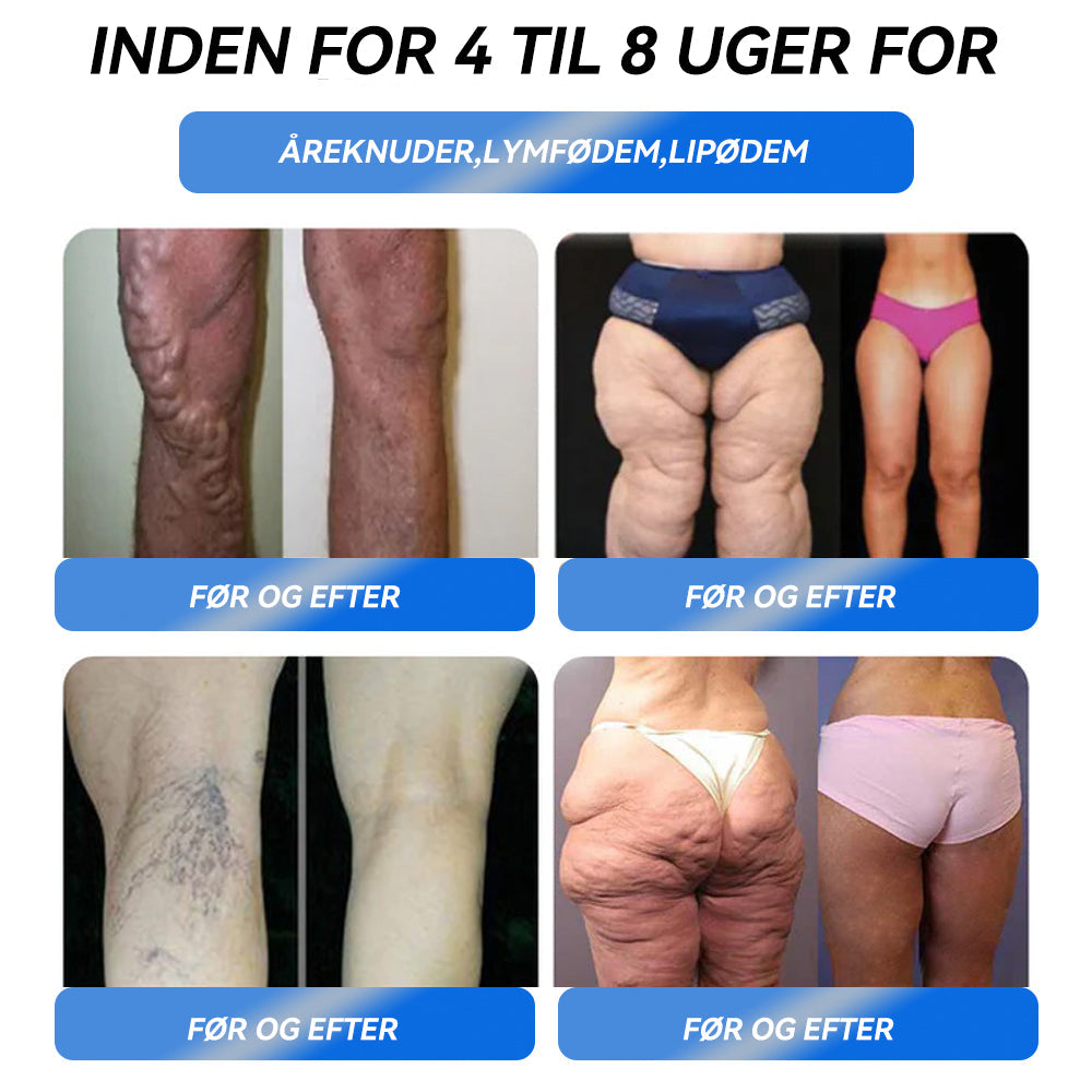 IFMAGIC® GLP-1 Pro Vægttab Oral Opløsning👩‍⚕️En dosis om dagen – synlige resultater inden for 7 dage🔥Velegnet til kroniske sygdomme, fedme, diabetes, hjerte-kar-sygdomme 🎖️