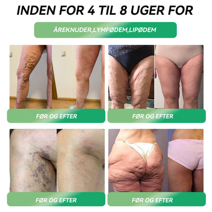 🎁Tillykke! Du er en af vores heldige vindere! 💪 Som vores eksklusive lykkestjerne får du nu en fantastisk rabat på 20%! Gå ikke glip af denne unikke mulighed for at forkæle dig selv med noget helt særligt! 🛍️💫